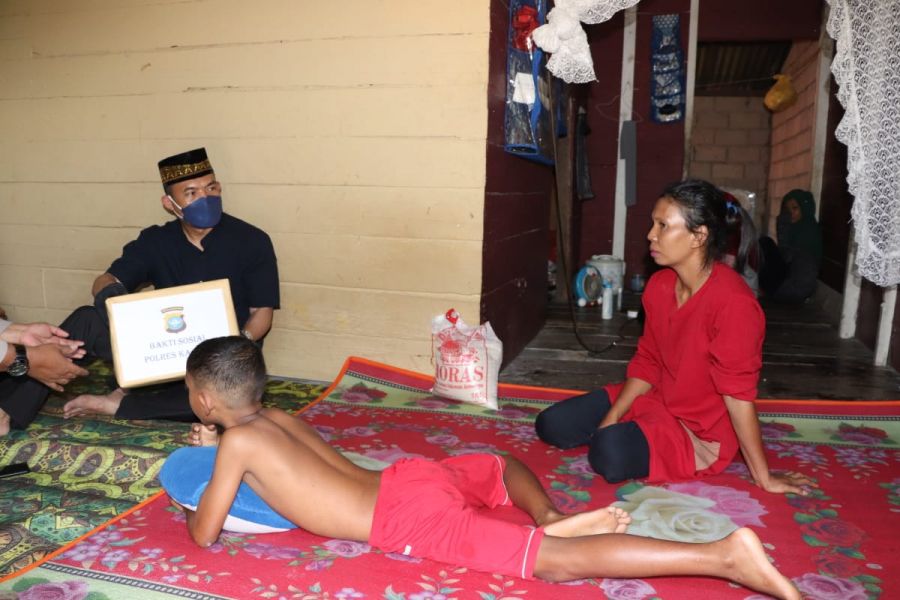 Kapolres Karimun Santuni Pirdaus Anak Yang Mengalami Luka Bakar